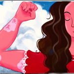 “What’s That On Your Hand?”: What’s It Like to Live with a Permanent Skin Disorder